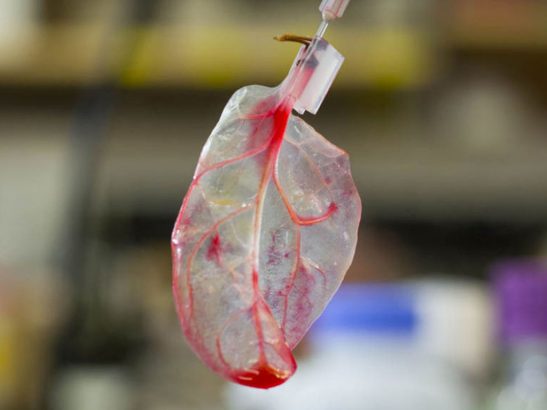Des-feuilles-d-epinards-transformees-en-tissu-cardiaque-humain